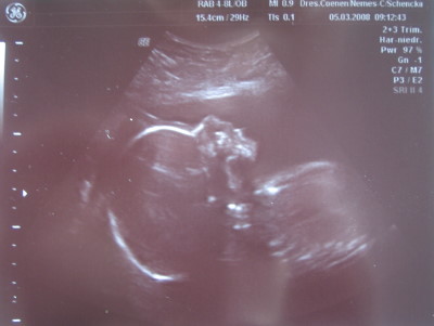 Ultraschall 24+6